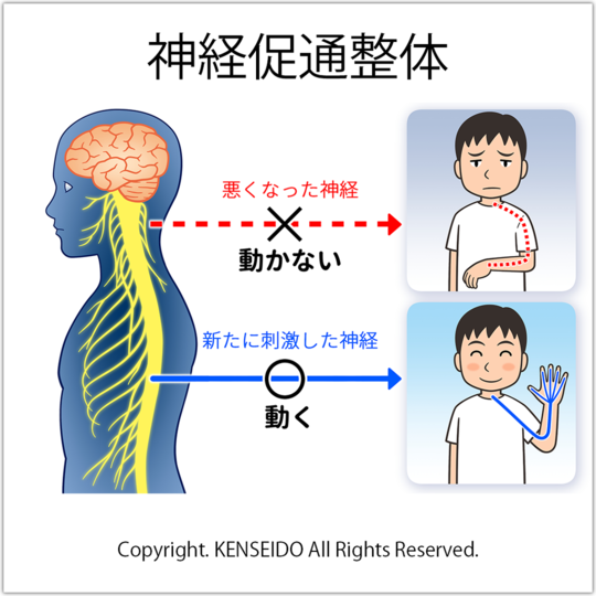 脳梗塞リハビリ 片麻痺 - 川崎市の健成堂整体院